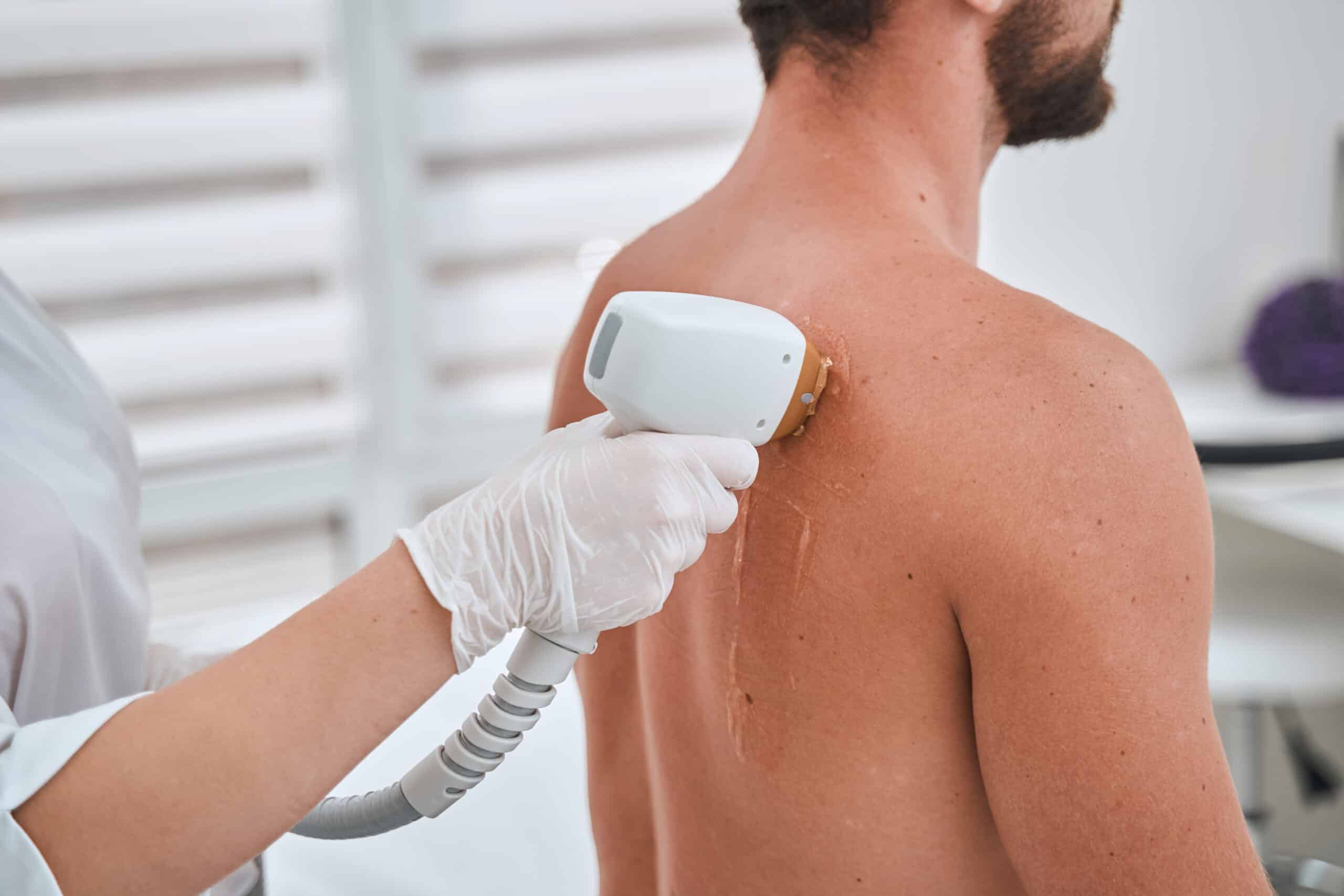 Creating educational laser hair removal social media content — Reels and TikTok that answer patient objections and drive qualified bookings
