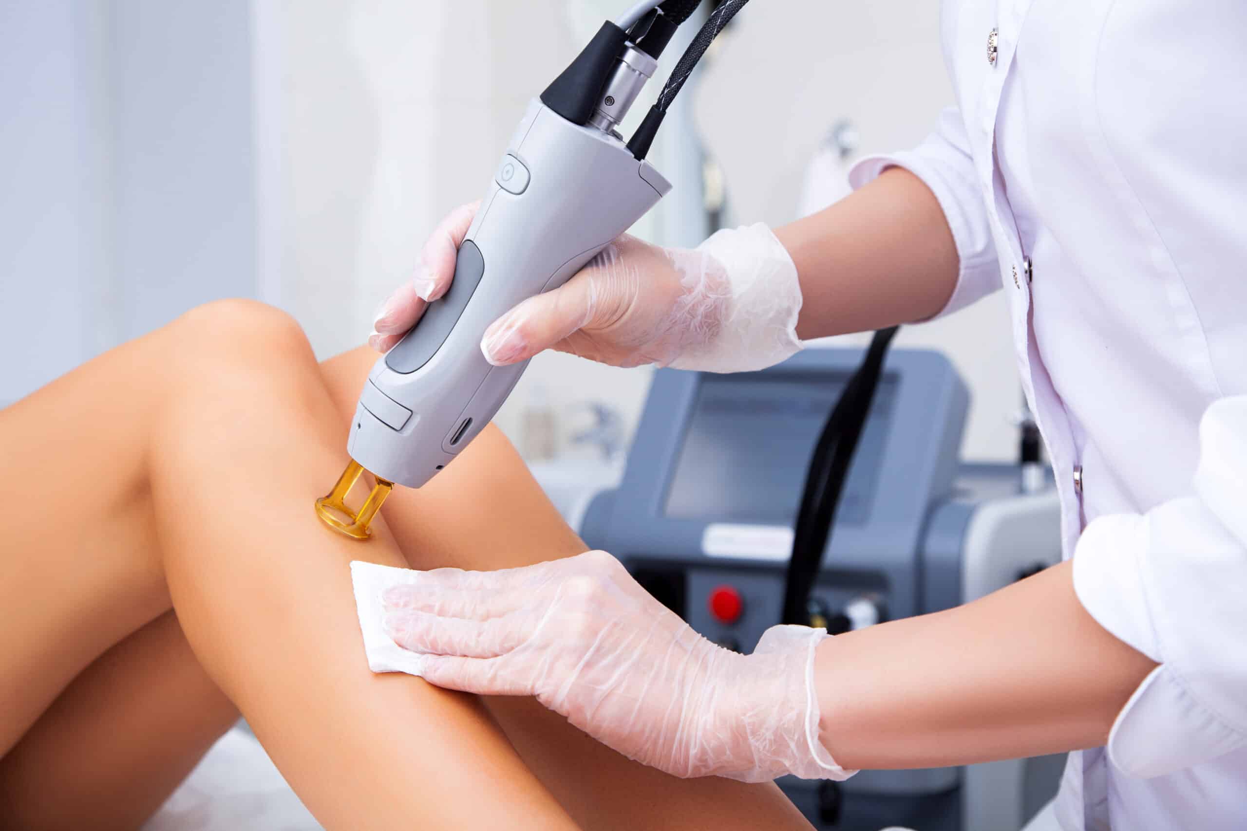 Skinspire's 90-day laser hair removal marketing onboarding — foundation, content, and multi-session nurture built in sequence