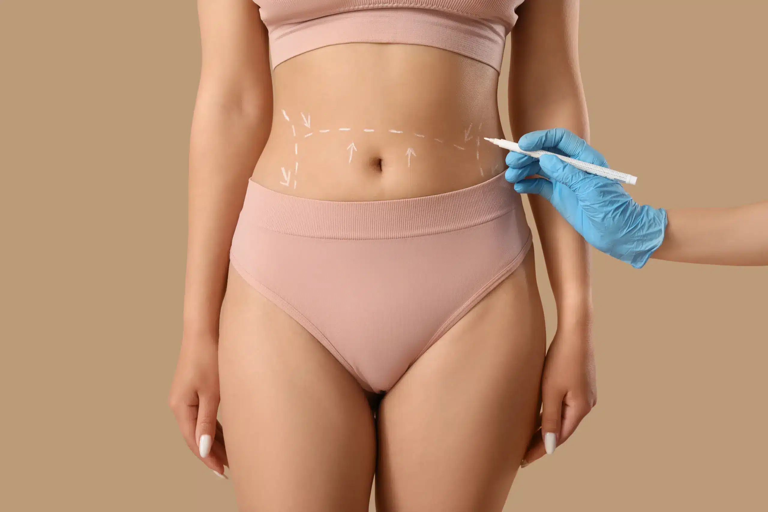 Mommy makeover SEO services building a component-led keyword cluster for tummy tuck, breast surgery and liposuction