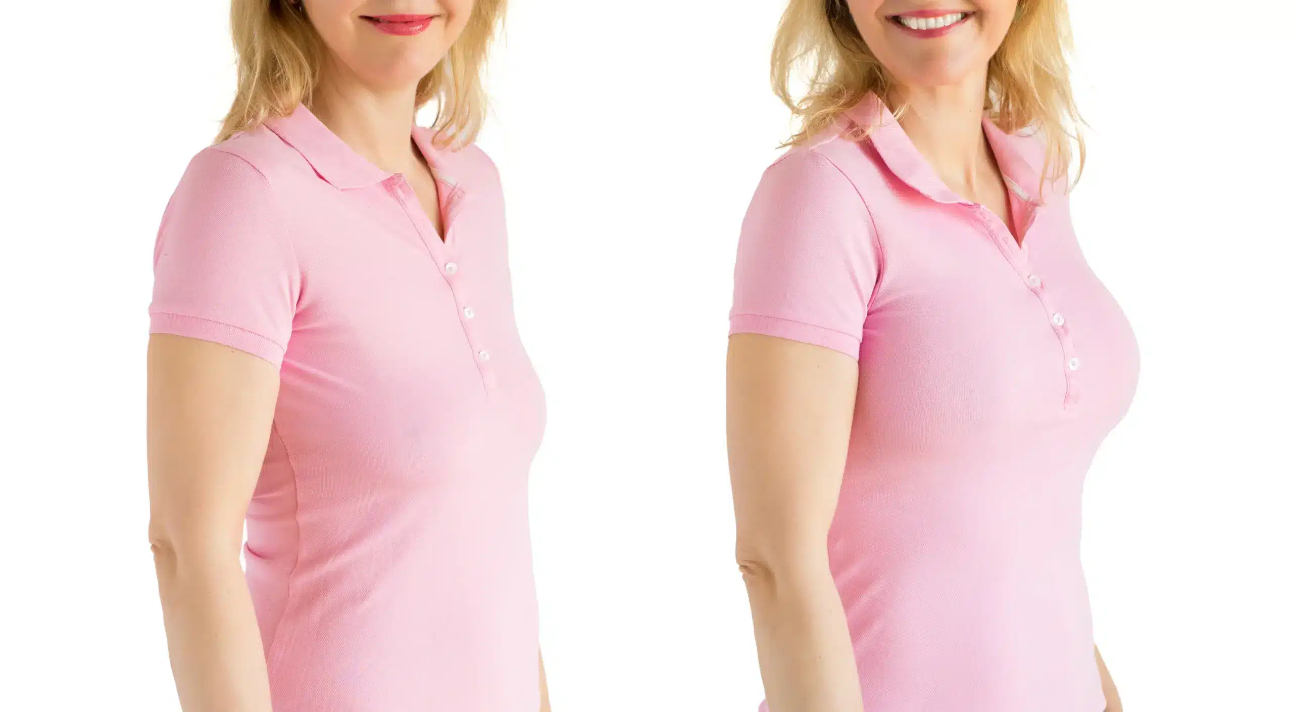 SEO for mommy makeover clinics showing consented before-and-after results on real postpartum bodies to build trust