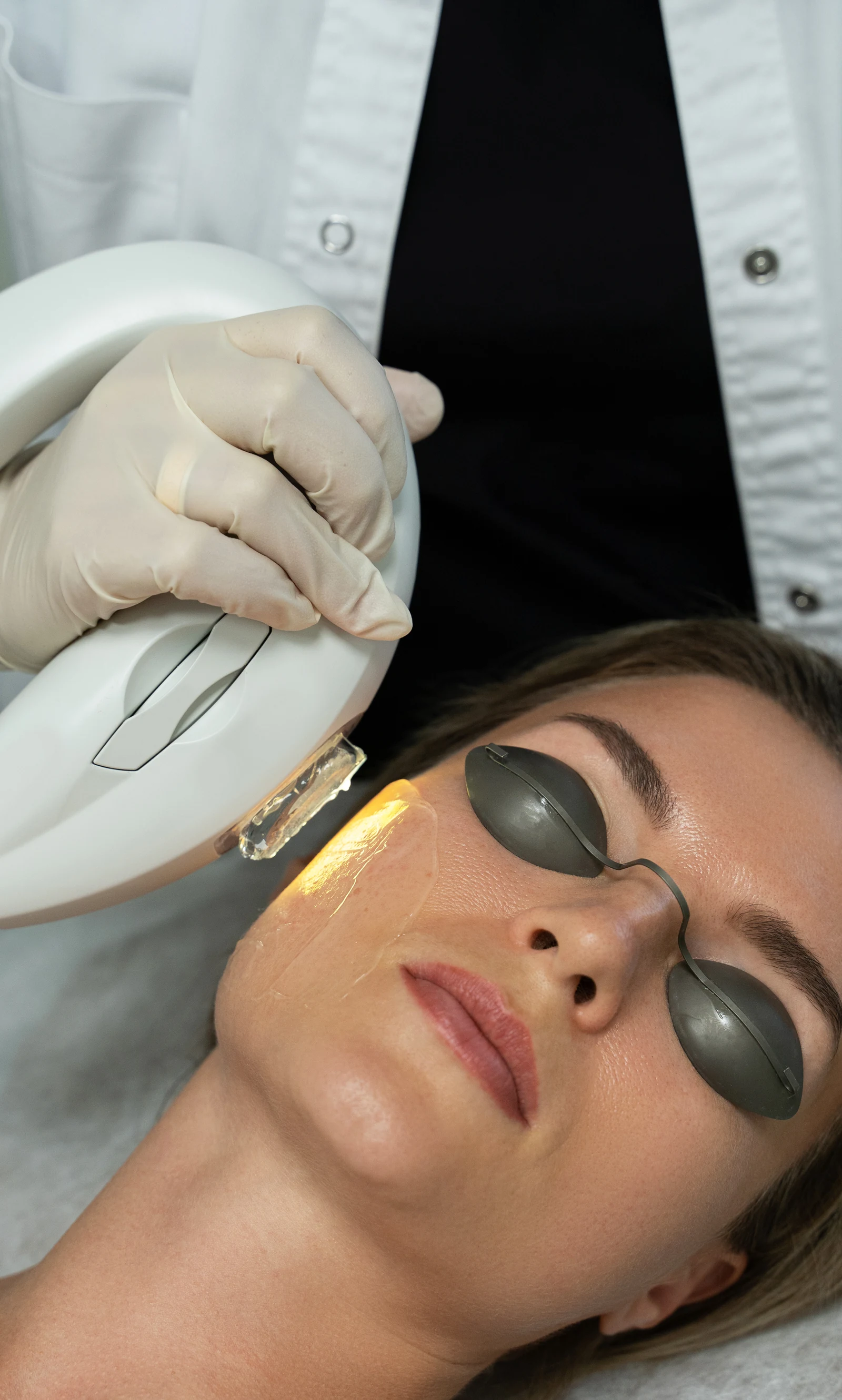 A patient receiving an IPL laser skin treatment at an aesthetic clinic