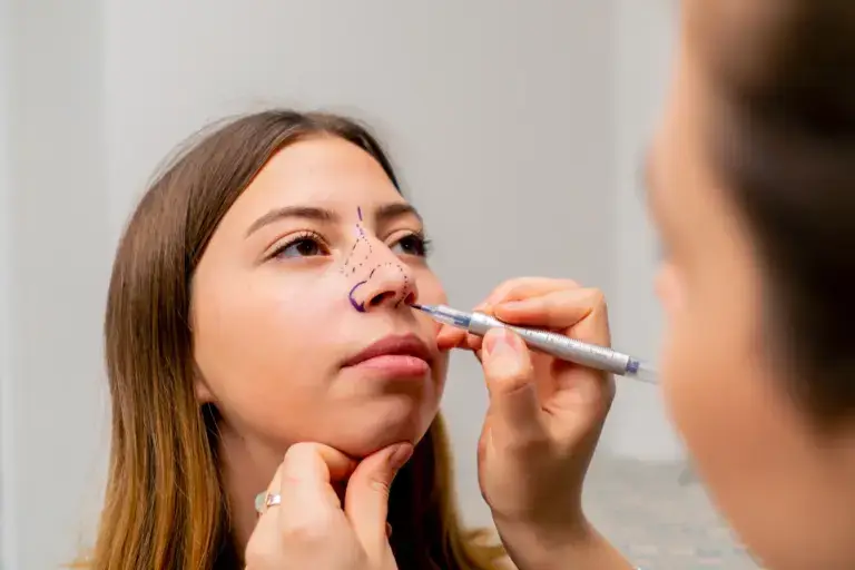 plastic-surgery-west-palm-beach-rhinoplasty-consult