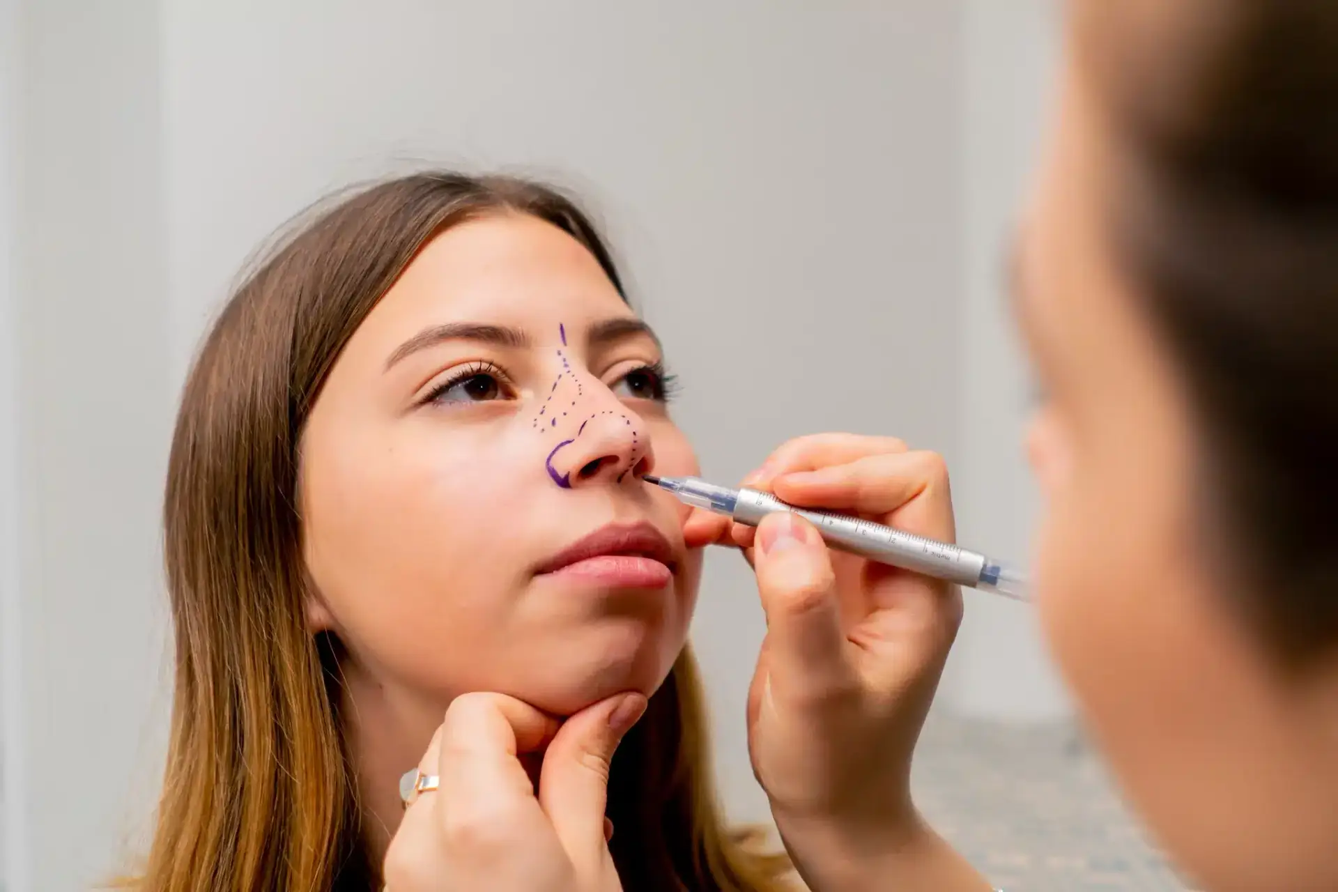 A board-certified plastic surgeon marking a West Palm Beach rhinoplasty patient